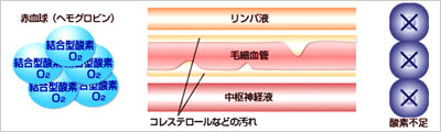 酸素カプセル