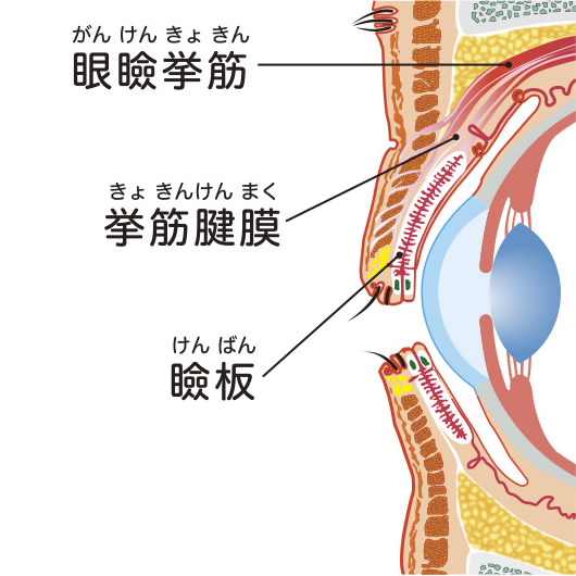 眼瞼下垂