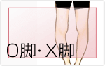 O脚・X脚